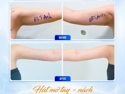 Bí Quyết Diện Đồ Đẹp Không Cần Che Giấu 0
