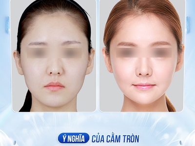 Cằm tròn đầy: Biểu tượng cuộc sống giàu sang viên mãn 0