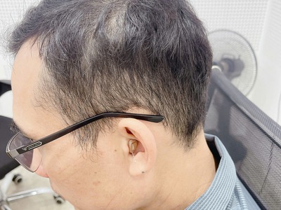 Máy trợ thính Tâm An Hải Dương 343 hải dương 1