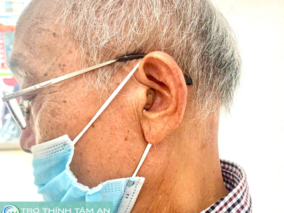 Máy trợ thính nhỏ gọn, kín đáo trong tai 1