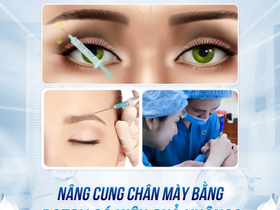 Nâng cung chân mày bằng botox 0
