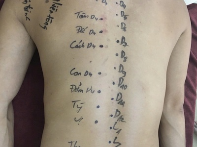 Khai Giảng Lớp Xoa Bóp Bấm Huyệt - Cấp Chứng Chỉ 0