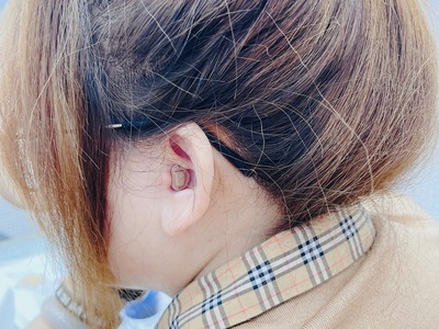 Khi phiên dịch viên bị nghe kém 4