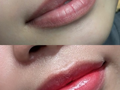 Combo xử lý thâm và phun môi Choushi - Giải pháp cho đôi môi tươi tắn, tự nhiên 1