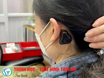 Máy trợ thính đường xương Adhear 3