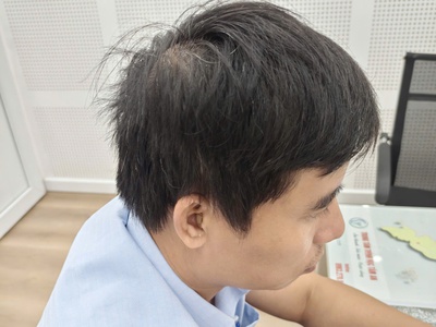 Phonak Terra  RIC 312   Giải pháp trợ thính thế hệ mới, giúp bạn nghe rõ, nói tự tin mọi nơi. 1