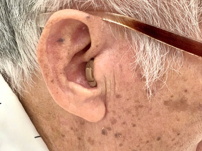 Máy trợ thính Prompt CIC nhỏ gọn trong tai, mạnh mẽ trong từng âm thanh 2