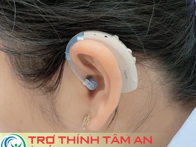 Máy Trợ Thính Signia Motion P 1PX   Giảm Ồn, Nghe Rõ, Dùng Cả Ngày 2