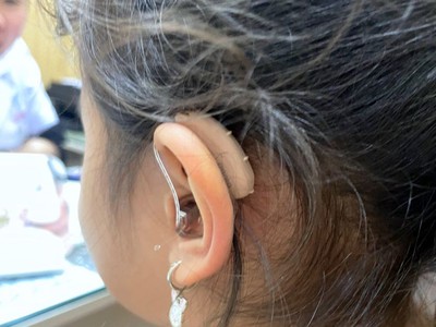 Máy trợ thính chính hãng Hải Phòng - Trợ thính Tâm An 5