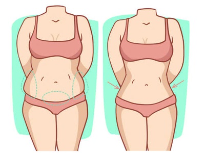 Hút mỡ bị lồi lõm có chỉnh sửa được không 0