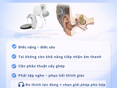 Giải pháp giúp nghe tốt hơn tại Thái Bình 1