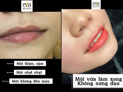Môi thâm, nhợt nhạt, không đều màu, ... Đến Eva Spa nhé 1