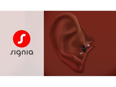 Bạn gặp khó khăn khi trò chuyện nơi đông người 2