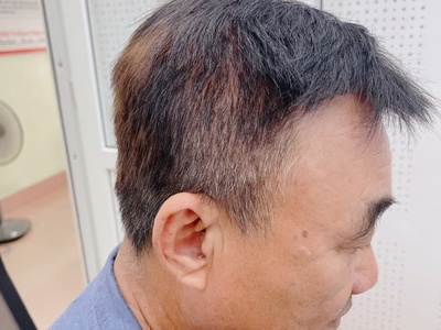 Bạn gặp khó khăn khi trò chuyện nơi đông người 5