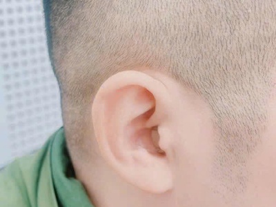 Bạn gặp khó khăn khi trò chuyện nơi đông người 7