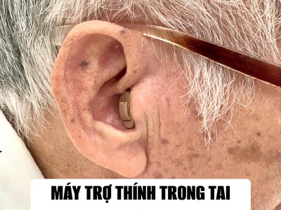 Máy trợ thính - Món quà tết ý nghĩa dành tặng người thân nghe kém 1