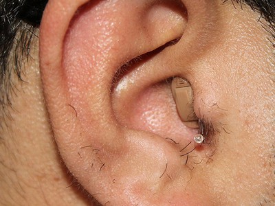 Máy trợ thính Prompt CIC   Nhỏ gọn, kín đáo nhưng nghe rõ ràng hơn mỗi ngày 1