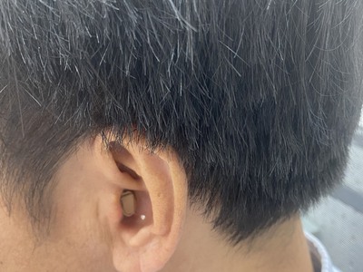 Máy trợ thính, máy trợ thính trong tai CIC 1