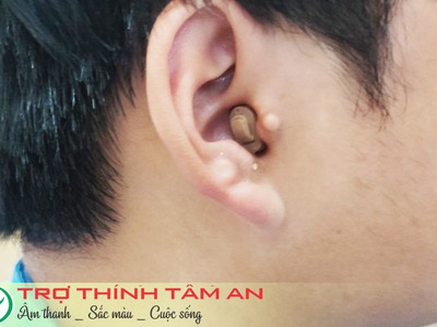 Máy trợ thính, máy trợ thính trong tai CIC 2