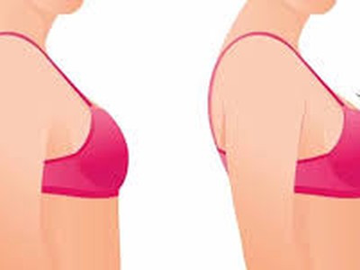 Hành trình hồi phục sau nâng ngực 0