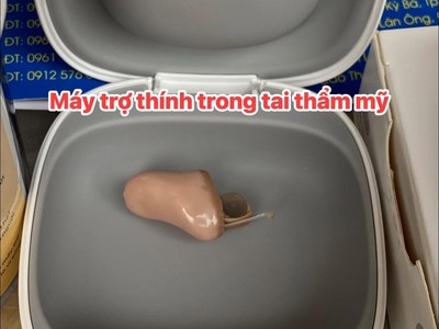 Lắp đặt máy trong tai thẩm mỹ cho bác khách ở Văn Giang   Hưng yên 0