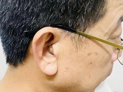 Lắp đặt máy trong tai thẩm mỹ cho bác khách ở Văn Giang   Hưng yên 1