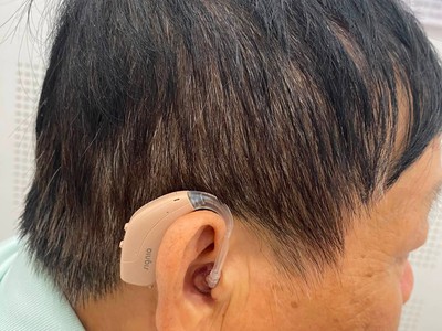 Mua máy trợ thính cần đạt niềm tin đúng chỗ 6